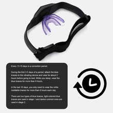 Charger l&#39;image dans la galerie, teeth straightening